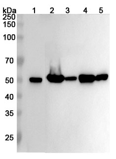 Anti-Human TUBB3 Polyclonal Antibody binds to TUBB3, C-His, recombinant protein in WB Assay