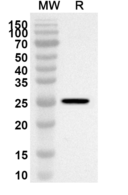 Anti-Human TWIST2 Polyclonal Antibody binds to Human TWIST2 Recombinant Protein, N-GST & C-His in WB Assay