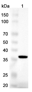 Anti-Human TWSG1 Polyclonal Antibody binds to Recombinant Human TWSG1, N-His in WB Assay