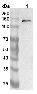 Anti-Human ULK1 Polyclonal Antibody binds to Recombinant Human ULK1 Protein, N-His in WB Assay