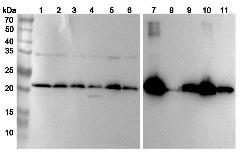 Anti-Human UQCRFS1 Polyclonal Antibody binds to Recombinant Human UQCRFS1 Protein, N-His in WB Assay