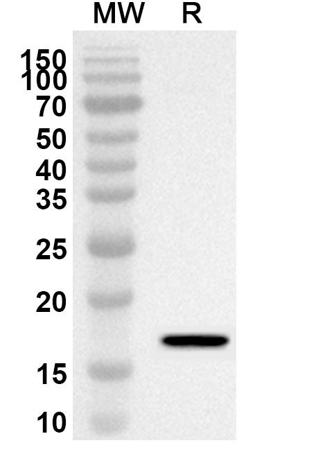 Anti-Human USF1 Polyclonal Antibody binds to Recombinant Human USF1 Protein, N-His in WB Assay
