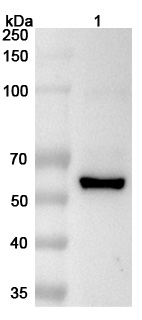 Anti-Human USP2 Polyclonal Antibody binds to Recombinant Human USP2 Protein, N-His in WB Assay