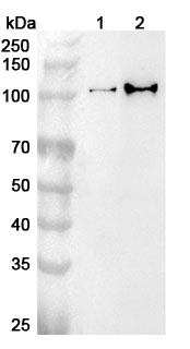 Anti-Human USP4 Polyclonal Antibody binds to Recombinant Human USP4 Protein, N-His in WB Assay