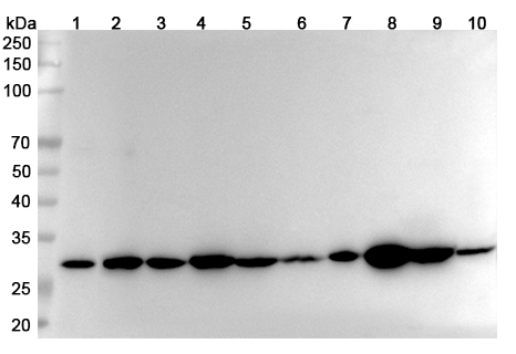 Anti-Human VAPB Polyclonal Antibody binds to Recombinant Human VAPB Protein, N-His in WB Assay