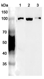 Anti-Human VCP Polyclonal Antibody binds to Recombinant Human VCP Protein, N-His in WB Assay