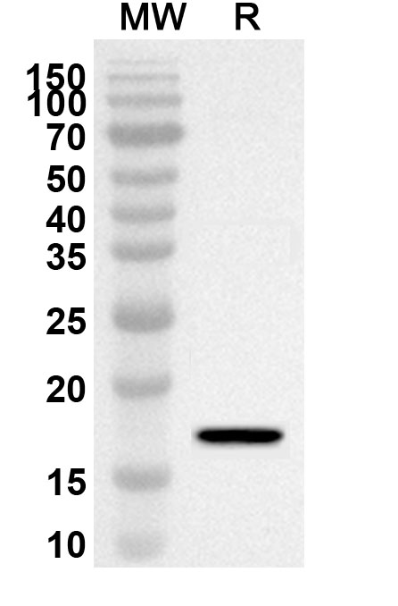 Anti-Human WBP2NL Polyclonal Antibody binds to Recombinant Human WBP2NL Protein, N-His in WB Assay