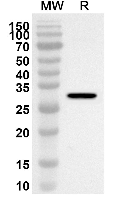 Anti-Human WRAP53 Polyclonal Antibody binds to Recombinant Human WRAP53 Protein, N-His in WB Assay