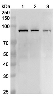 Anti-Human XRCC1 Polyclonal Antibody binds to Recombinant Human XRCC1, N-His in WB Assay