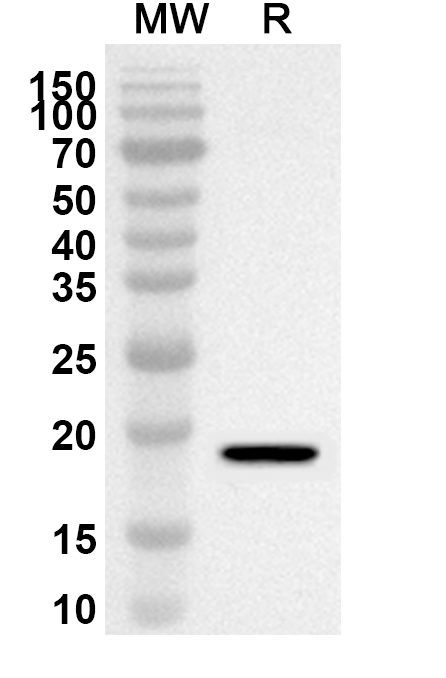 Anti-Human ZC3H12D Polyclonal Antibody binds to Recombinant Human ZC3H12D Protein, N-His in WB Assay