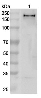 Anti-Human ZEB1 Polyclonal Antibody binds to Human ZEB1 Recombinant Protein, N-His in WB Assay