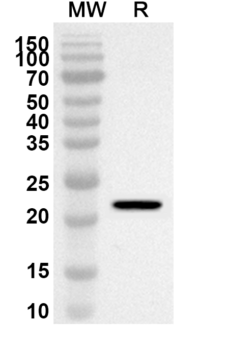 Anti-Human ZNF202 Polyclonal Antibody binds to Recombinant Human ZNF202 Protein, N-His in WB Assay