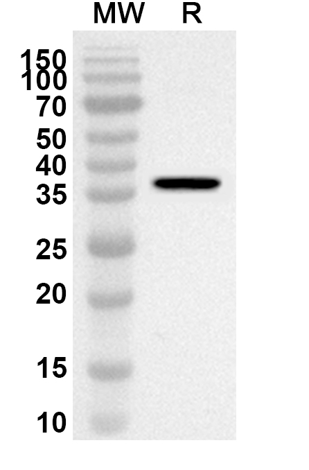 Anti-Human ZNHIT1 Polyclonal Antibody
