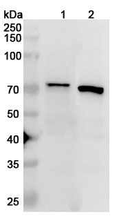 Anti-IGF2BP3 Polyclonal antibody binds to Recombinant Human IGF2BP3, N-His in WB Assay