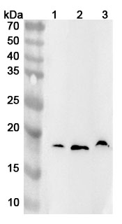 Anti-IL18BP Polyclonal antibody binds to Recombinant Mouse IL18BP Protein, N-His in WB Assay