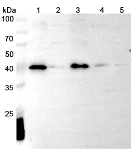 Anti-IL36A/IL-1F6 Polyclonal antibody binds to Recombinant Human IL36A/IL-1F6, N-His in WB Assay
