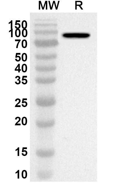 Anti-Influenza A virus NP/Nucleoprotein Polyclonal Antibody binds to Recombinant Influenza A virus NP/Nucleoprotein Protein, N-GST & C-His in WB Assay