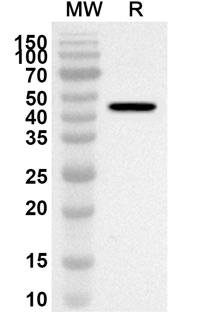 Anti-IRF4 Polyclonal antibody binds to Recombinant Human IRF4, N-His in WB Assay