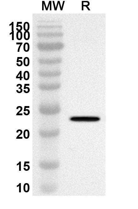 Anti-ITGA10 Polyclonal Antibody binds to Recombinant Human ITGA10, N-His in WB Assay