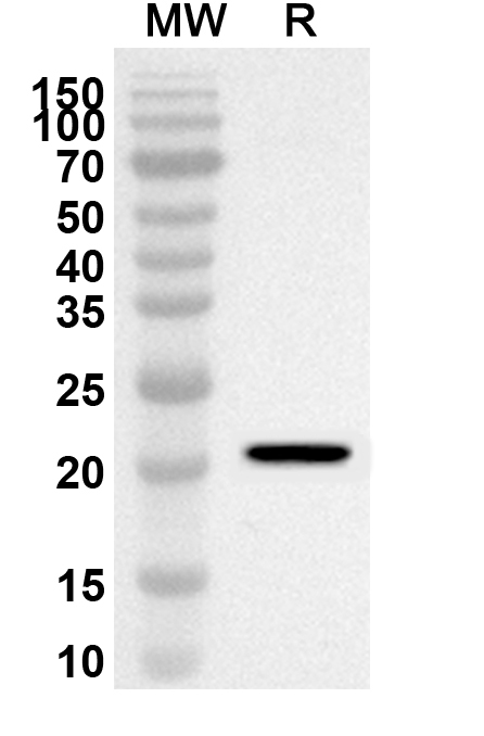 Anti-ITIH3 Polyclonal antibody binds to Recombinant Human ITIH3, N-His in WB Assay