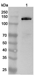 Anti-IVL Polyclonal antibody binds to Recombinant Human IVL, N-His in WB Assay