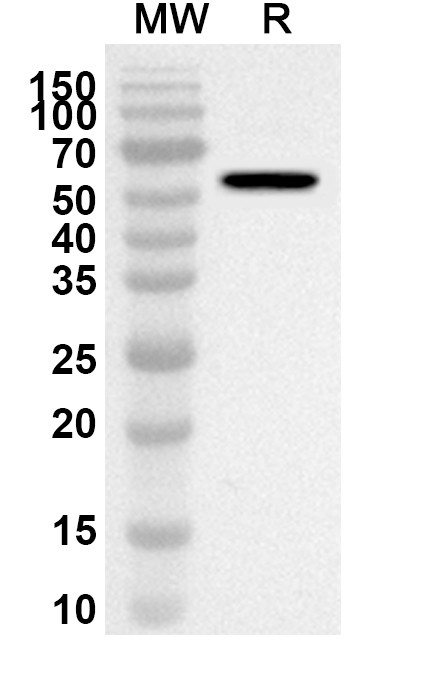 Anti-KLB Polyclonal antibody binds to Recombinant Human KLB, N-His in WB Assay