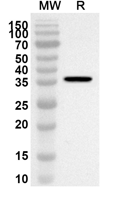 Anti-KRT5 Polyclonal antibody binds to Recombinant Human KRT5, N-His in WB Assay