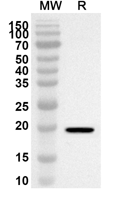 Anti-LOXL4 Polyclonal antibody binds to Recombinant Human LOXL4, N-His in WB Assay