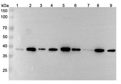 Anti-MACROH2A1 Polyclonal antibody binds to Recombinant Human MACROH2A1, N-GST in WB Assay