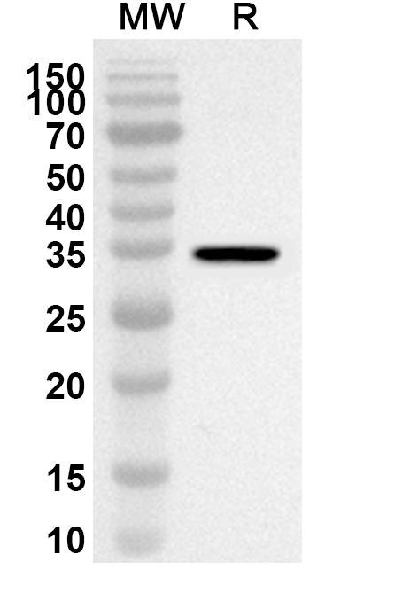 Anti-MAPK11 Polyclonal antibody binds to Recombinant Human MAPK11, N-His in WB Assay