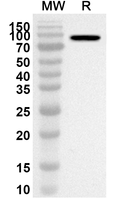 Anti-MDM2 Polyclonal Antibody binds to Recombinant Human MDM2 Protein, N-His in WB Assay