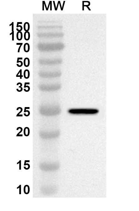 Anti-MGMT Polyclonal antibody binds to Human MGMT Recombinant Protein, N-His in WB Assay
