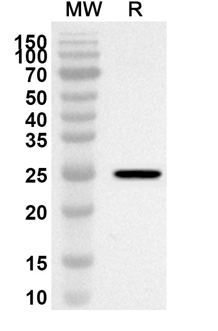 Anti-Mouse APCDD1 Polyclonal Antibody binds to Recombinant Mouse APCDD1 Protein, N-His in WB Assay