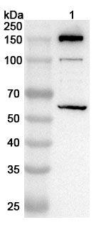 Anti-Mouse C4B Polyclonal Antibody binds to Recombinant Mouse C4B Protein, N-His in WB Assay