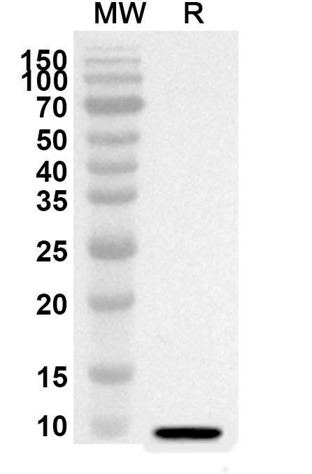 Anti-Mouse CCL28/MEC Polyclonal Antibody binds to Recombinant Mouse CCL28/MEC Protein, N-His in WB Assay