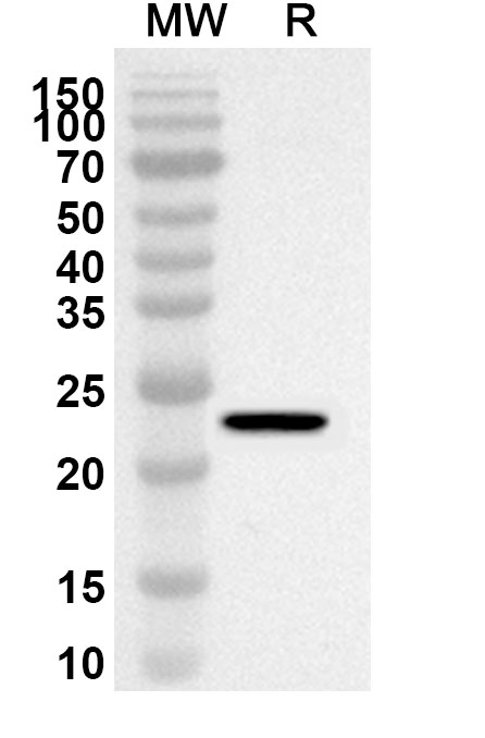Anti-Mouse CD200R1L Polyclonal Antibody binds to Recombinant Mouse CD200R1L Protein, N-His in WB Assay