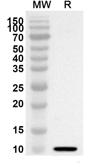 Anti-Mouse CD267/TNFRSF13B Polyclonal Antibody binds to Mouse CD267/TNFRSF13B Recombinant Protein, C-His in WB Assay