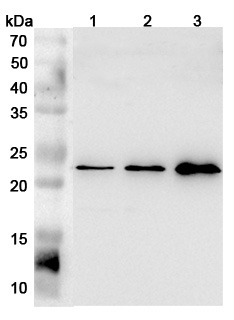 Anti-Mouse FGF21 Polyclonal Antibody binds to Human FGF21 recombinant protein in WB Assay
