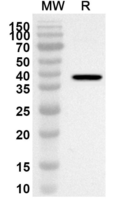 Anti-Mouse GIT2 Polyclonal Antibody binds to Recombinant Mouse GIT2 Protein, N-His in WB Assay