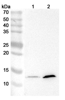 Anti-Mouse IFNAR1 Antibody (MAR1-5A3) binds to Recombinant Mouse IFNAR1 Protein, N-His in WB Assay