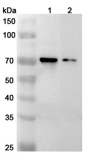 Anti-Mouse IL1RL2/IL-36R Polyclonal Antibody binds to Mouse IL1RL2/IL-36R Recombinant Protein, C-His in WB Assay