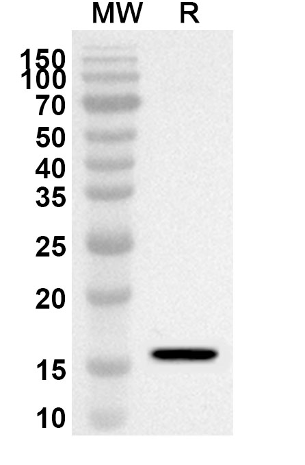 Anti-Mouse IL21 Polyclonal Antibody binds to Recombinant Mouse IL21 Protein, N-His in WB Assay