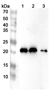 Anti-Mouse LCN2 Polyclonal Antibody binds to Recombinant Mouse LCN2 Protein, N-His in WB Assay
