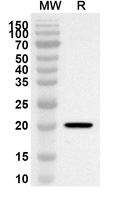 Anti-Mouse MFAP5 Polyclonal Antibody binds to Recombinant Mouse MFAP5 Protein, N-His-SUMO in WB Assay