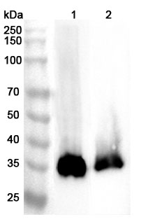 Anti-Mouse PPT1 Polyclonal Antibody binds to Recombinant Human PPT1 Protein, N-His in WB Assay
