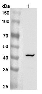 Anti-Mouse ST6GALNAC2/SIAT7-B Polyclonal Antibody binds to Mouse ST6GALNAC2/SIAT7-B Recombinant Protein, C-His in WB Assay