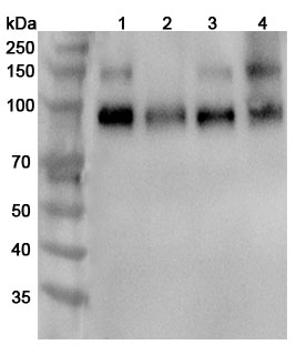 Anti-Mouse TrkB /NTRK2 Polyclonal Antibody binds to Mouse TrkB/NTRK2 Recombinant Protein, C-His in WB Assay