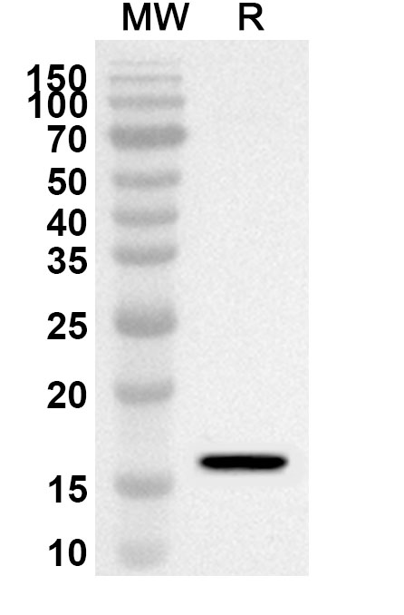 Anti-Mouse VSTM2A Polyclonal Antibody binds to Recombinant Mouse VSTM2A Protein, N-His in WB Assay