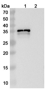 Anti-MPXV B6R/SL-159 Antibody (hMB668) in WB Assay