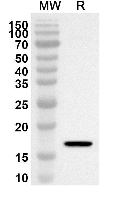Anti-MSX2 Polyclonal Antibody binds to Recombinant Human MSX2 Protein, N-His in WB Assay